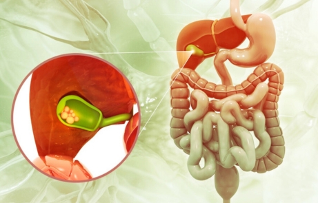 symptoms of Gall Bladder